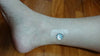 Image of GROUNDED Meridian Dot (Reusable) - Acupuncture Tuning
